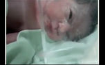 عجیب ترین حاملگی یک زن ایرانی / شوک هنگام زایمان در بیمارستان + فیلم و عکس